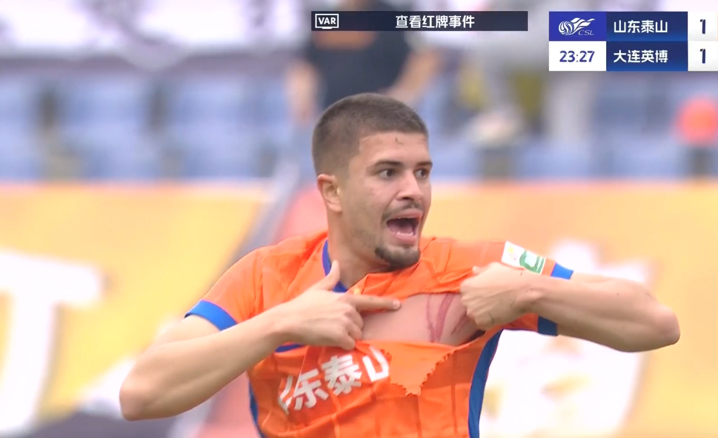 大連少打一人！卡蘭加蹬踏直紅，卡扎爾球衣被蹬爛+胸部三道血痕