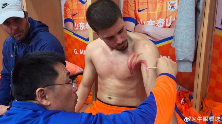 硬漢！記者曬卡扎爾受傷照，肩胛及上臂處多條血痕