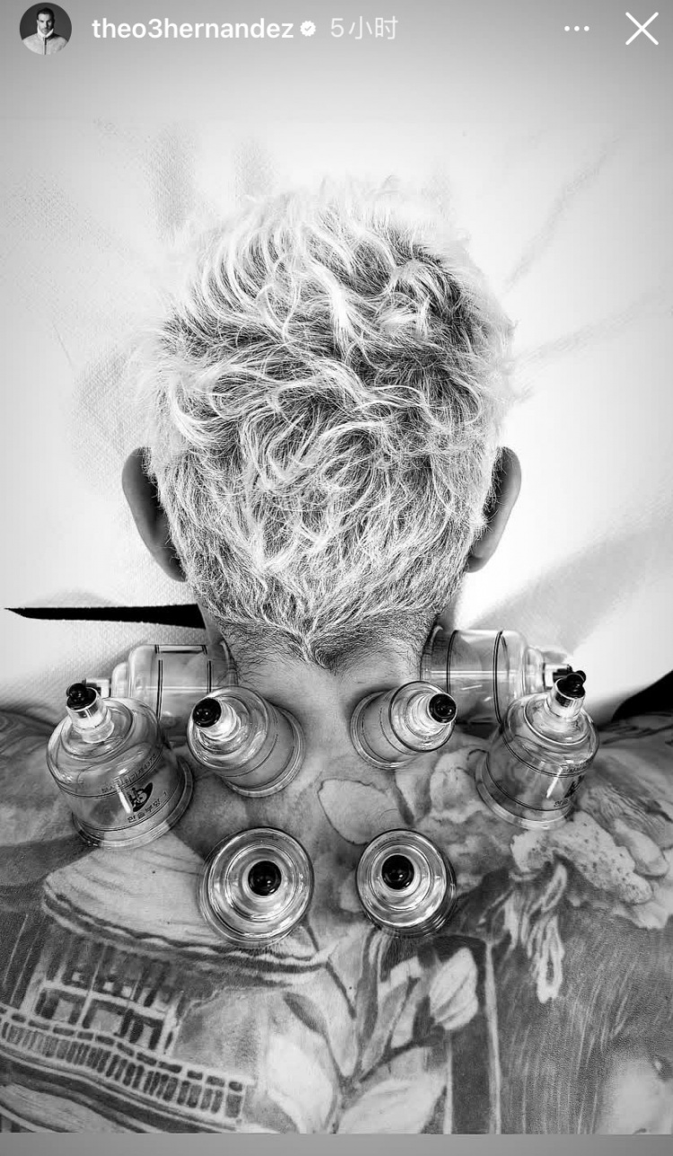 神秘東方力量加持？特奧社媒曬照，自己正在接受拔罐治療